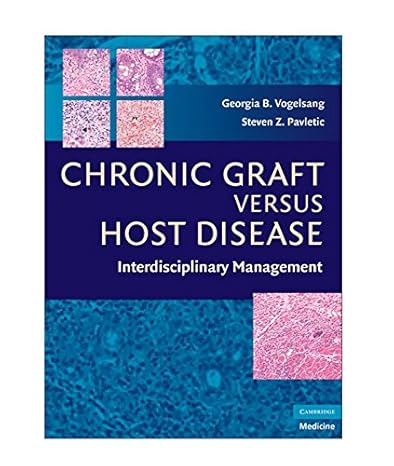 Chronic Graft Versus Host Disease: Interdisciplinary Management by Georgia B. Vogelsang | Cambridge University Press; 1st edition