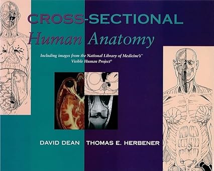 Cross-Sectional Human Anatomy by David Dean PhD | LWW