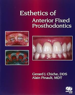 Esthetics of Anterior Fixed Prosthodontics by Gerard Chiche | Quintessence Pub Co; 1st edition