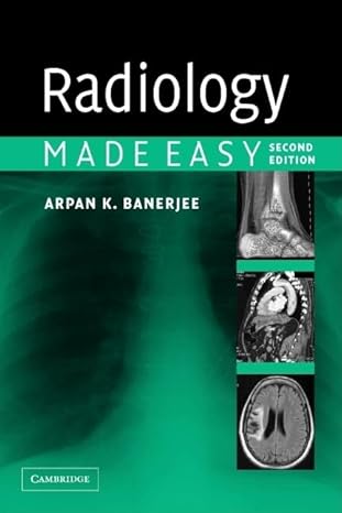Radiology Made Easy by Arpan K. Banerjee | Cambridge University Press; 2nd edition